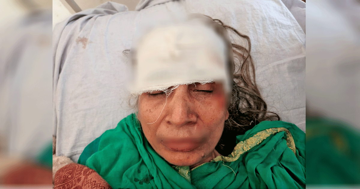 তালায় সাবেক জেলা পরিষদ সদস্যের মাকে পিটিয়ে হত্যার চেষ্টা: হাসপাতালে ভর্তি