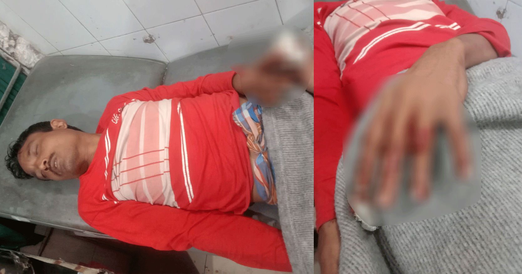 পলাশবাড়ীতে জামায়াতের হামলায় বিএনপির এজেন্ট নারী কর্মীসহ ২ জন আহত