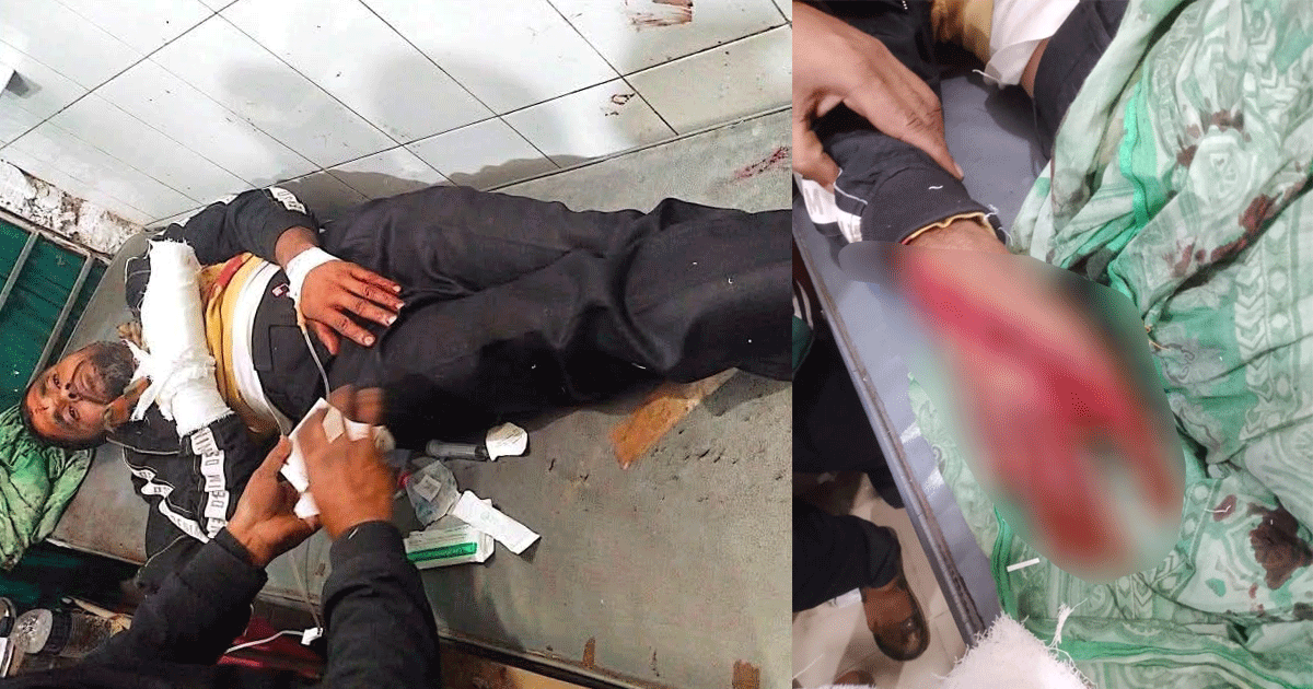 পলাশবাড়ীতে অন্ধকারে দুর্বৃত্তের হামলা, যুবদল নেতা গুরুতর আহত