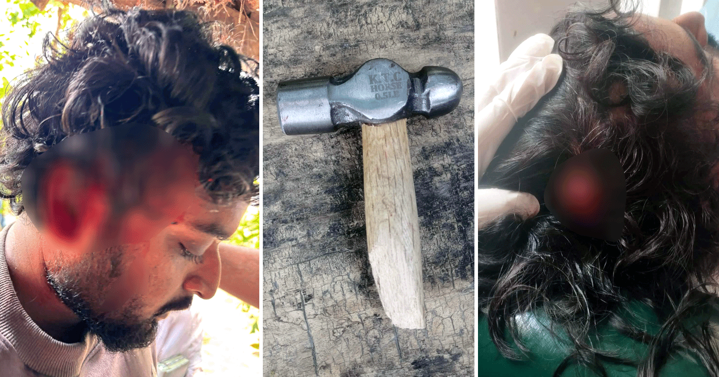 দোহারে কিশোর গ্যাংয়ের হামলায় আহত-৩