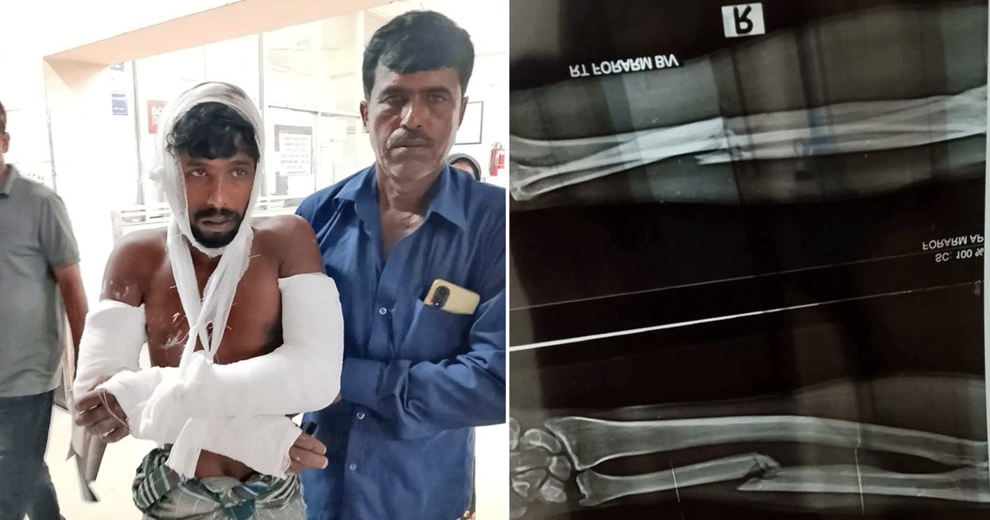 দোহারে মাছ চুরি ঠেকাতে গিয়ে বৈঠার আঘাতে জখম জেলে