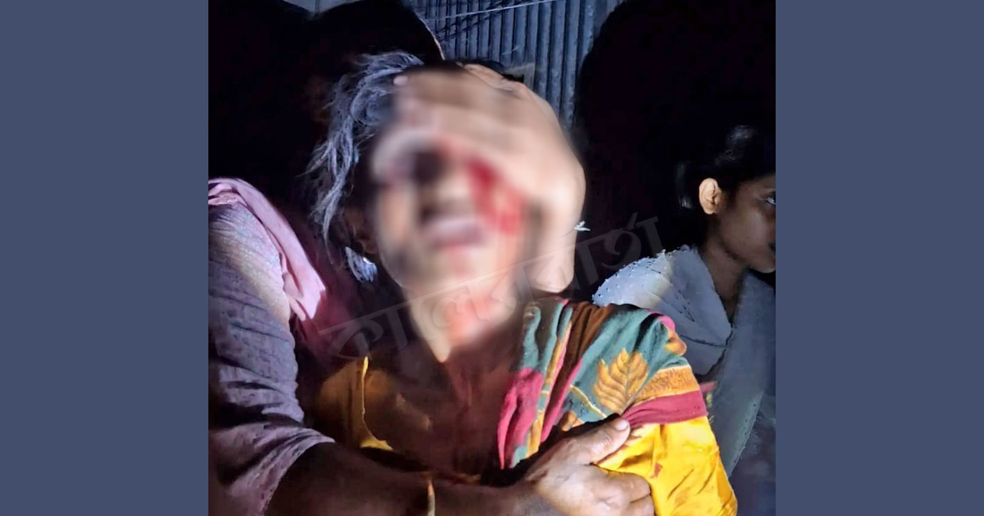 দোহারে টিউবলাইটের আঘাতে নারীর চোখ নষ্ট, মামলা ঠেকাতে হুমকির অভিযোগ