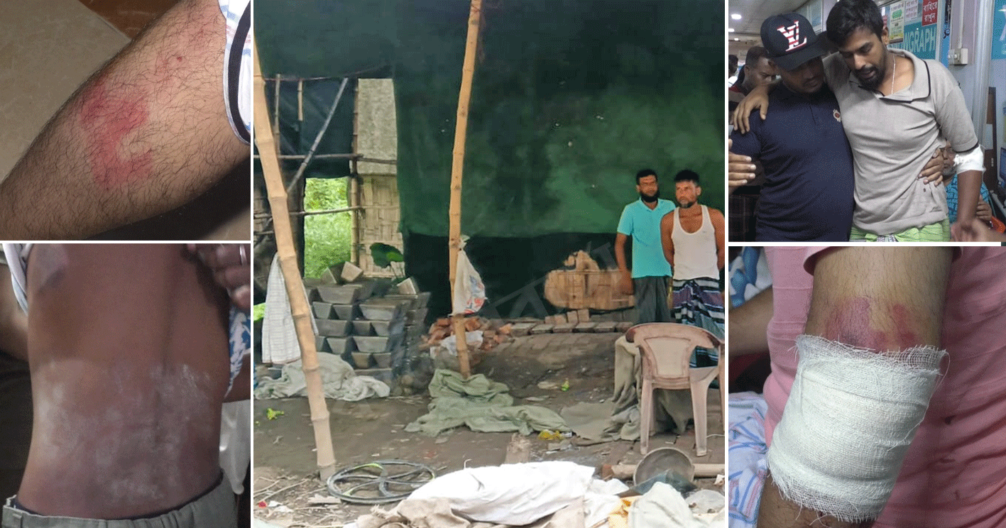 দোহারে অবৈধ সিলভার কারখানার প্রতিবাদ করায় এলাকাবাসীর ওপর হামলার অভিযোগ বিএনপি নেতার বিরুদ্ধে