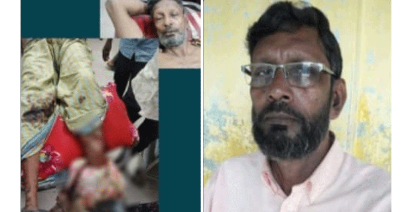 নলডাঙ্গায় দুর্বৃত্তের হামলায় আহত আওয়ামী লীগ নেতা চিকিৎসাধীন অবস্থায় মারা গেছেন