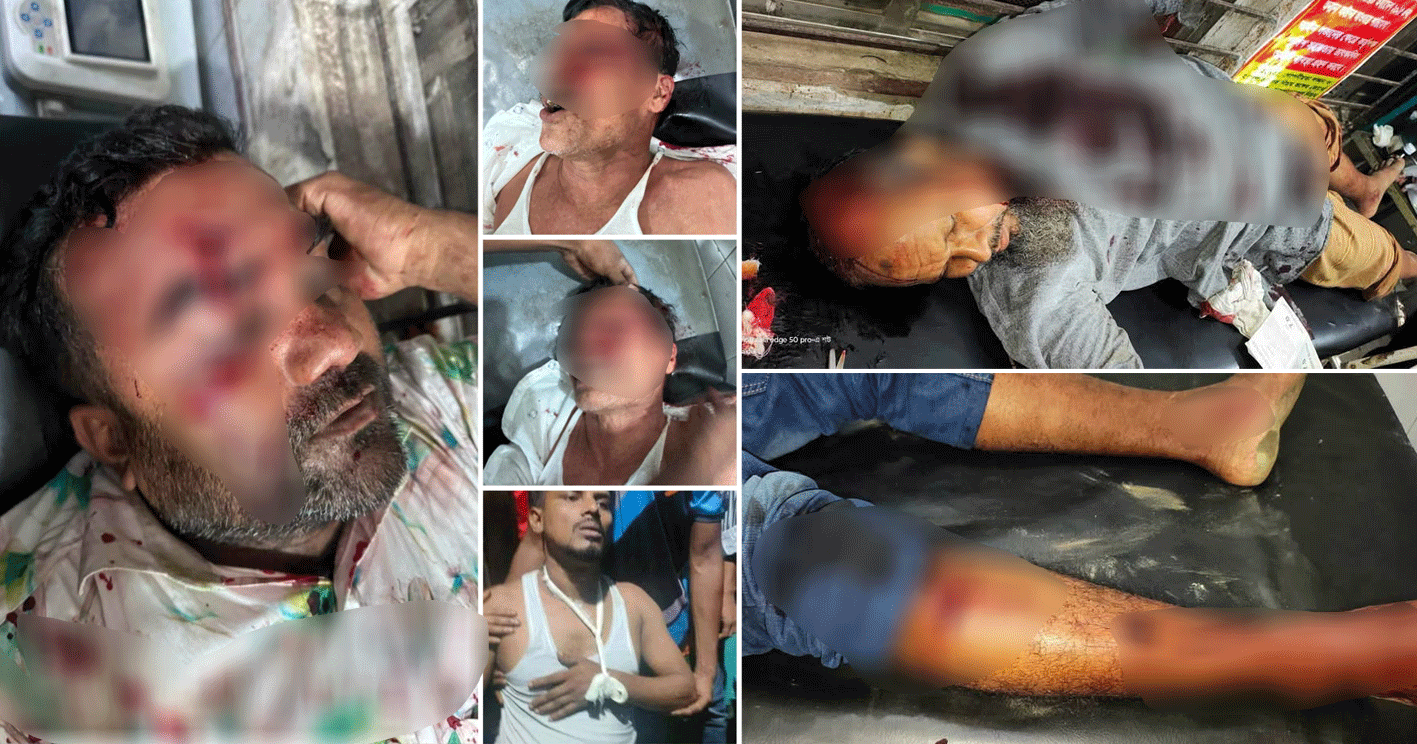 পলাশবাড়ীতে জামায়াত-বিএনপির মধ্যে দফায় দফায় তুমুল সংঘর্ষ, আহত ১০