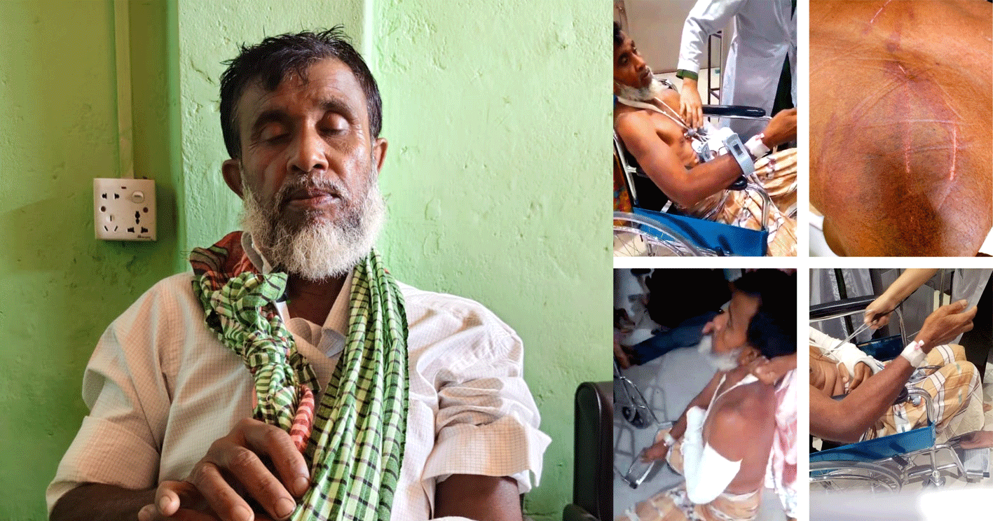 লামায় জমি বিরোধের জেরে বৃদ্ধের ওপর হামলা, হত্যা চেষ্টার অভিযোগে মামলা