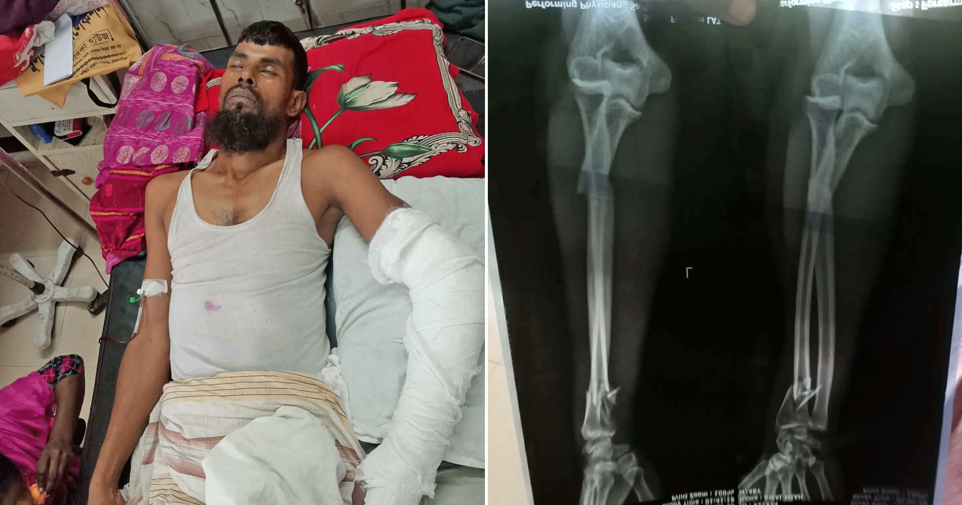কুলিয়ারচরে বিভাটেক চালকের ওপর হামলা ও মারধর; থানায় মামলা, বিবাদীদের হুমকির মুখে বাদীর পরিবার
