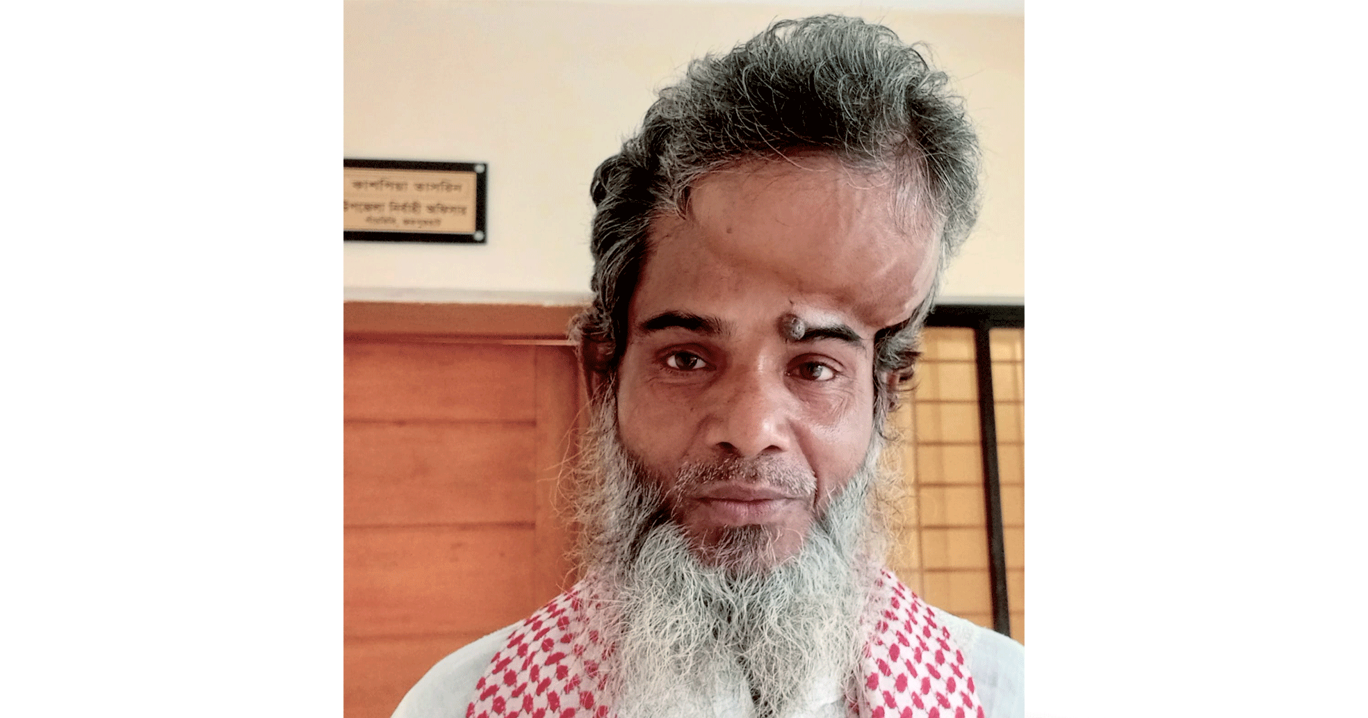 টাকার অভাবে থমকে আছে মাথায় টিউমার আক্রান্ত জয়নালের চিকিৎসা