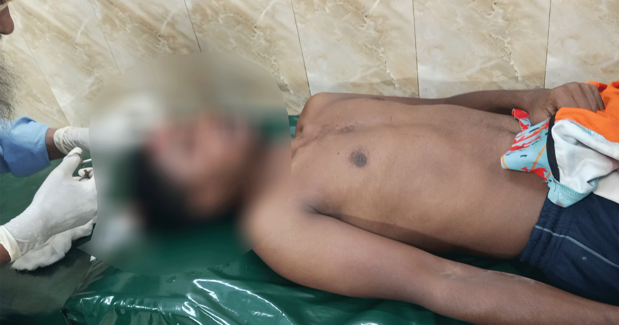 নলডাঙ্গায় খেলার মাঠে কথা-কাটাকাটি, যুবসংগঠনের নেতাকে পিটিয়ে জখম