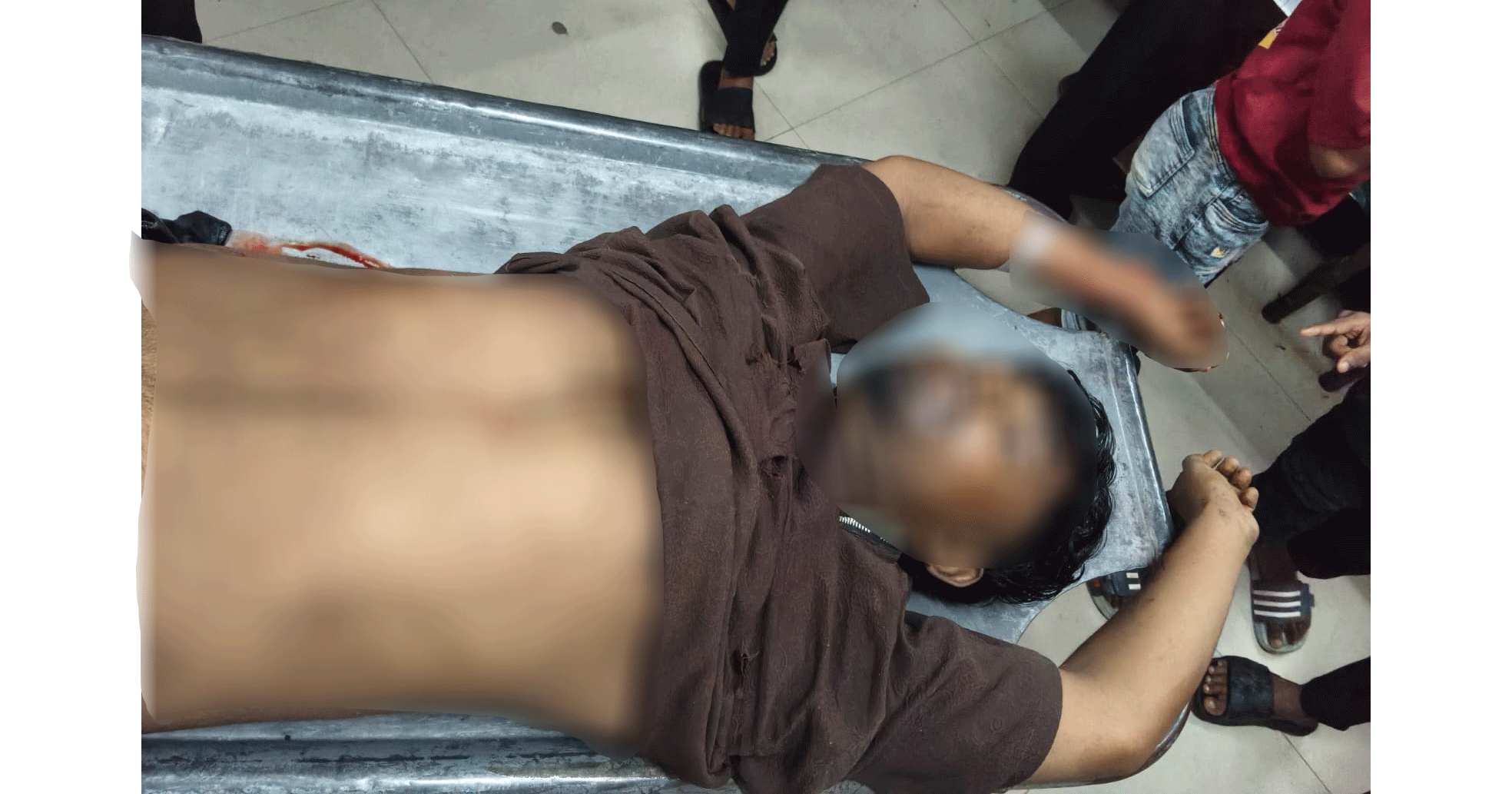 নলডাঙ্গার পাটুলে ব্যাটারিচালিত চার্জার গাড়ির সঙ্গে মুখোমুখি সংঘর্ষে মোটরসাইকেল চালক নিহত
