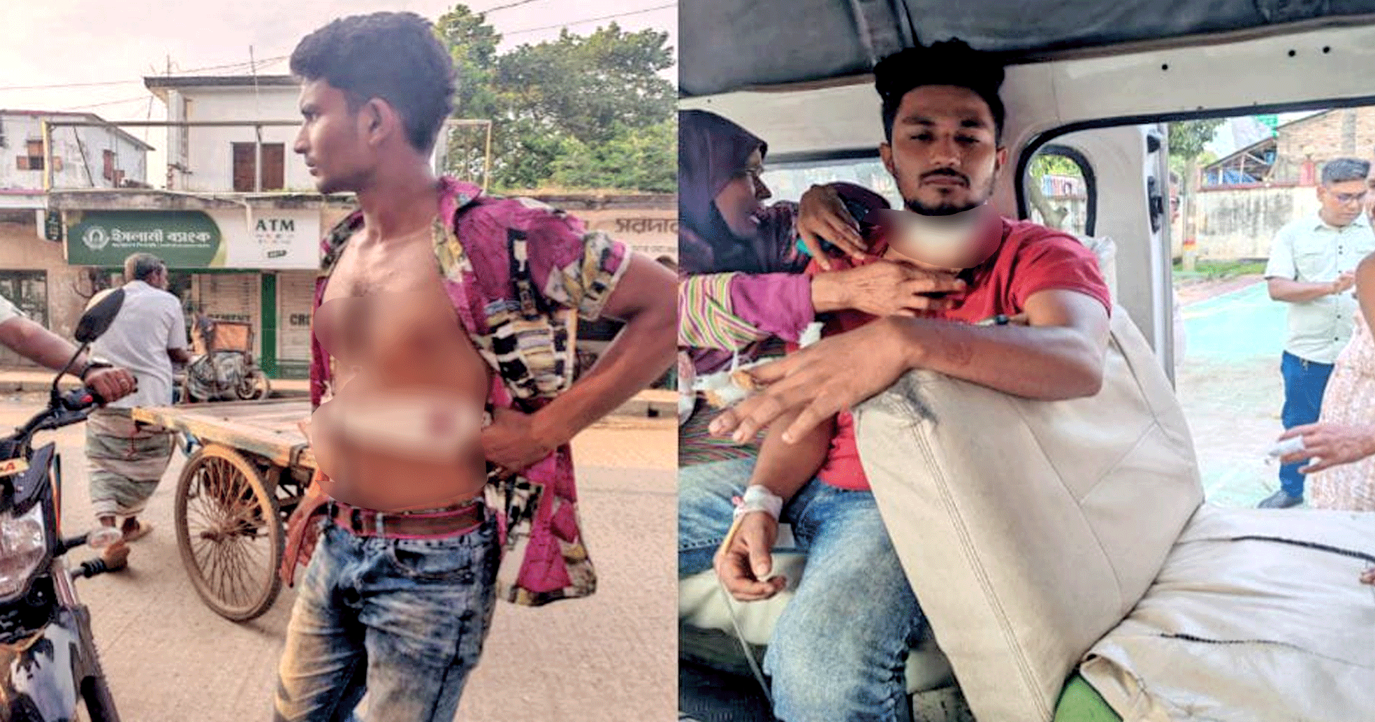 নলডাঙ্গায় জমি সংক্রান্ত বিরোধে দুই যুবককে কুপিয়ে জখম, হাসপাতালে ভর্তি