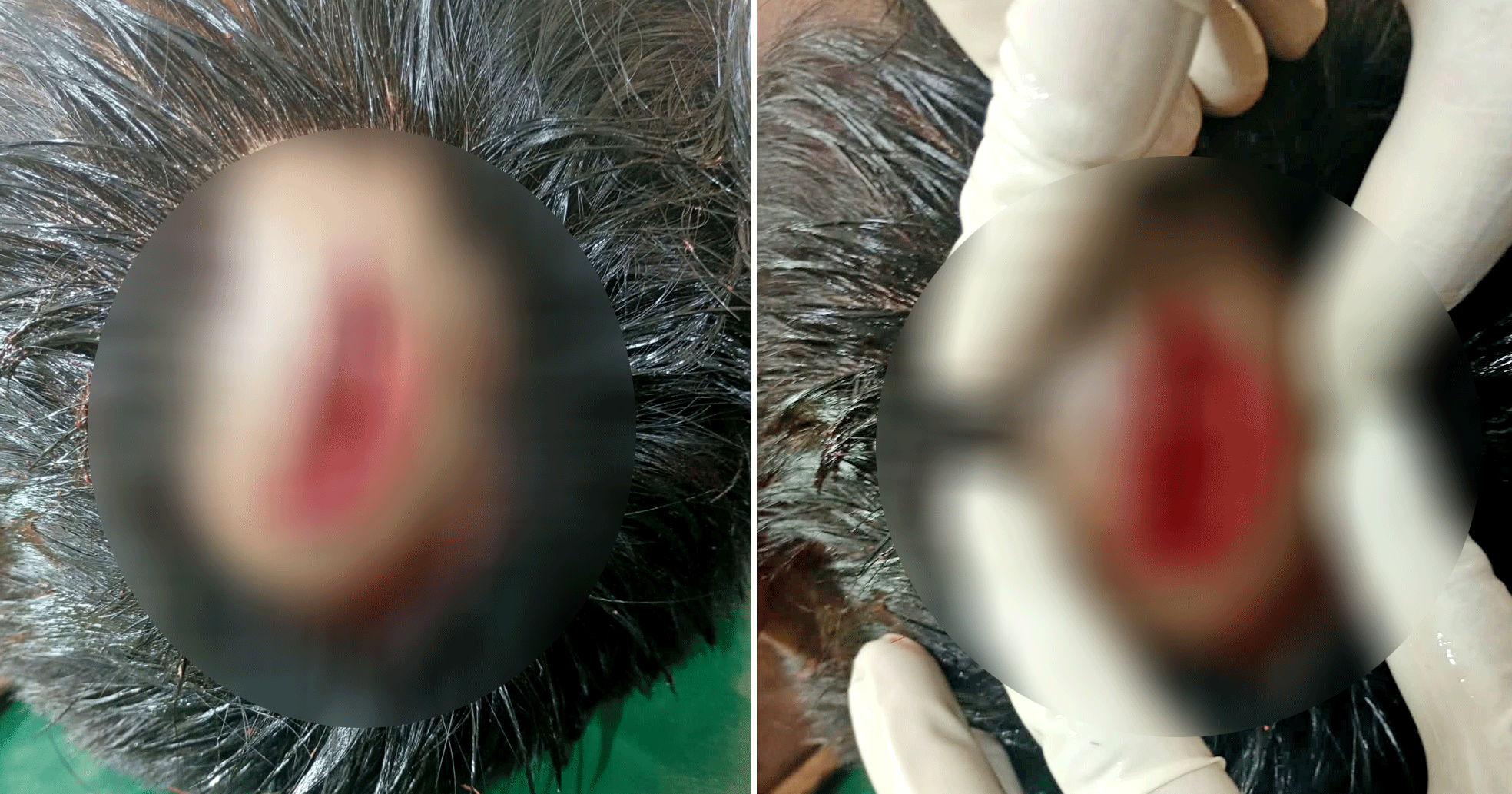 মাদ্রাসার চাকরিকে কেন্দ্র করে নাটোরের নলডাঙ্গায় রক্তক্ষয়ী সংঘর্ষ, আহত ৫