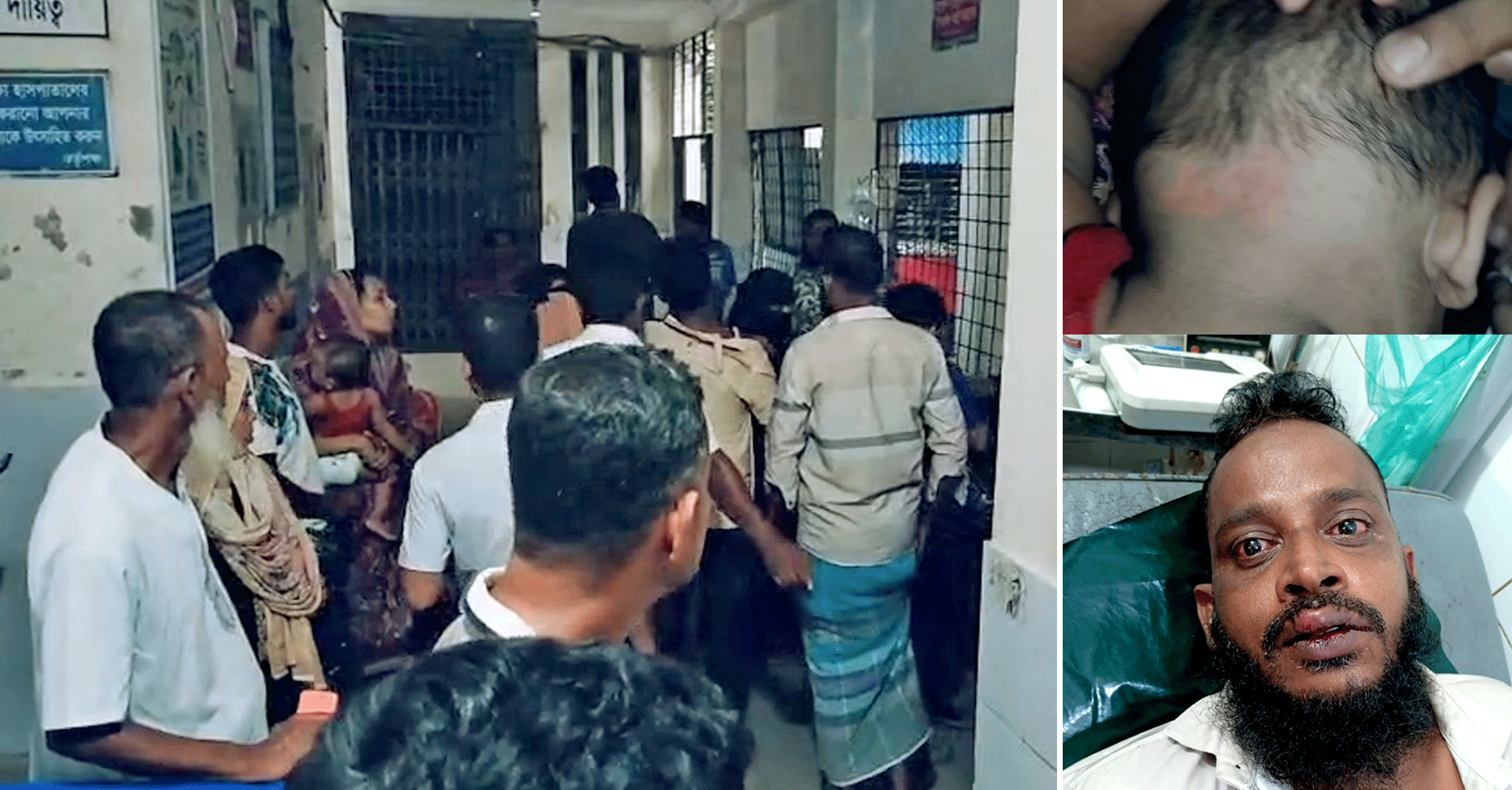 পূর্ব শত্রুতার জেরে দোহারে প্রতিবেশীর হামলা: নারী ও শিশুসহ আহত একাধিক, থানায় অভিযোগ