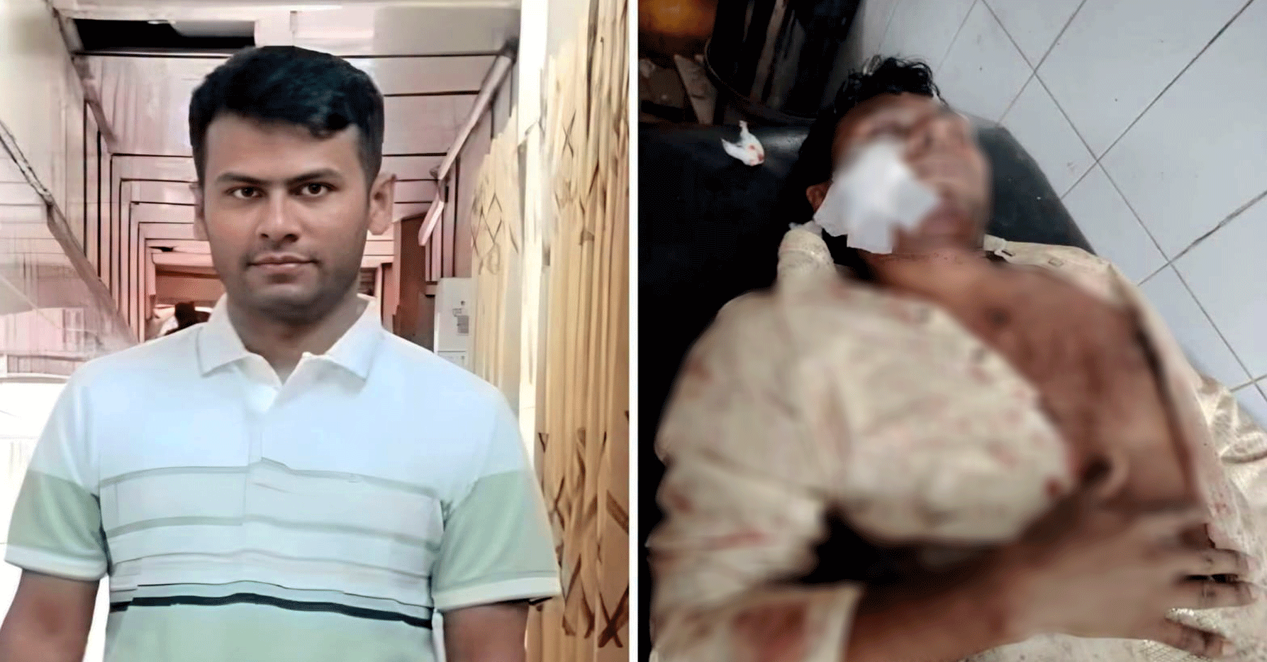 মাদকবিরোধী লাইভ দেওয়ার পর যুবদল নেতাকে কুপিয়ে জখম, আশঙ্কাজনক অবস্থায় ঢাকায় স্থানান্তর